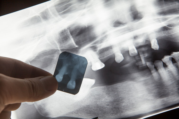 panoráma röntgen előnyei